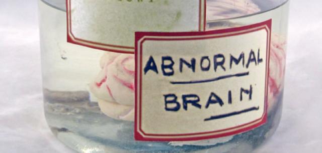 Abnormal Brain